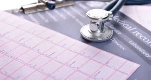 Oclusão do apêndice atrial esquerdo reduz ocorrência de AVC?