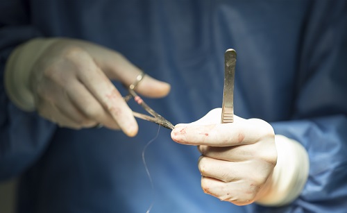 Qual o tempo ideal para realizar uma cirurgia eletiva após infecção por Sars-Cov-2?