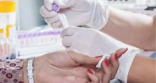 mão de paciente fazendo testes sorológicos após vacinação