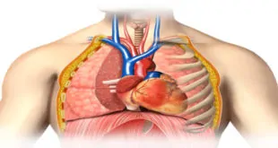 Crioablação versus antiarrítmicos para o tratamento de primeira linha da fibrilação atrial paroxística