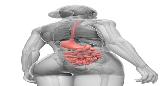 Síndrome de ruminação diagnóstico diferencial de doença do refluxo gastroesofágico refratária