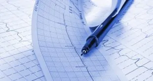estudo east-afnet avalia controle de ritmo na fibrilação atrial