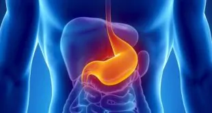 imagem digital de corpo humano mostrando onde acontece a doença do refluxo gastroesofágico