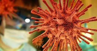 Diagnóstico e tratamento da aspergilose pulmonar invasiva associada à Covid-19