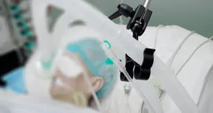 paciente em ventilação mecânica e hemodinâmica na sepse