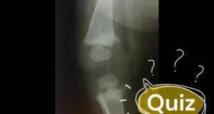 radiografia
