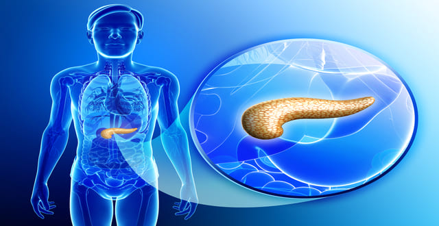 pancreatite