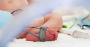 bebê prematuro em UTI devido a sepse tardia