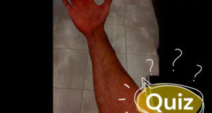 reação cutânea
