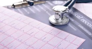 pericardiectomia para fibrilação atrial