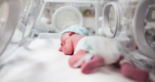 bebê com vasculite sistêmica neonatal