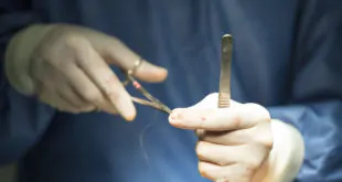 cirurgião terminando cirurgia para avaliar infecções periprotéticas