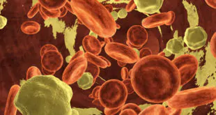 O uso de ferro por via intravenosa para o tratamento de anemia ferropênica é recomendado em muitas diretrizes clínicas devido à sua eficácia.