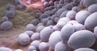 infecções fúngicas