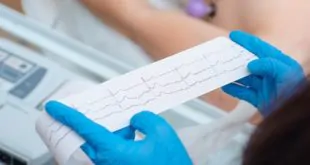 paciente com infarto com supra e qualidade de vida pós-revascularização