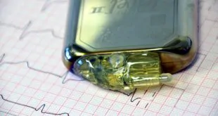infecções causadas por marca-passo e desfibriladores