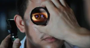 glaucoma de ângulo fechado