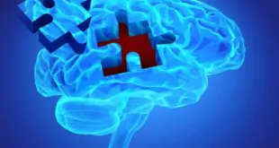 A pupilometria se correlaciona com o eletroencefalograma (EEG) não reativo em pacientes neurocríticos