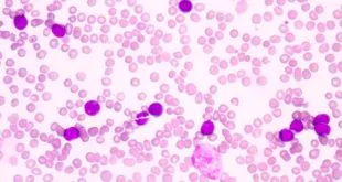 Anvisa importação de imunoglobulina humana poderá ser realizada até último dia de julho