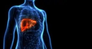 Quais são os preditores de sobrevida pós transplante hepático do paciente com NAFLD?