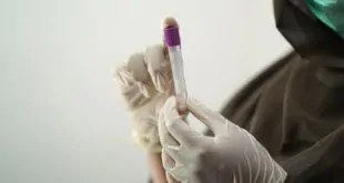 Marburg: OMS confirma surto do vírus “primo” do Ebola em Gana