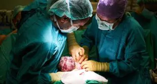 e paridade contribuem em casos de prolapso genital