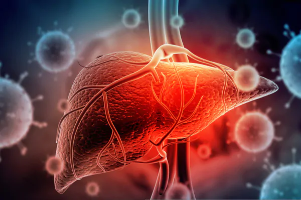 ACP 2023: Doença hepática gordurosa não alcoólica - como o clínico deve abordar?